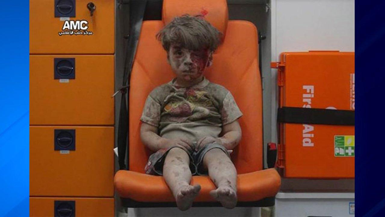 Omran Daqneesh el niño que le da rostro a la guerra en Siria, este video es lo más triste que hemos visto.